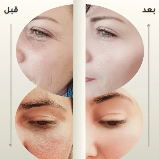 بشرة ناعمة، مشرقة، وخالية من الرؤوس السوداء والتصبغات بعد استخدام المقشر الأحمر من ذا اورديناري
